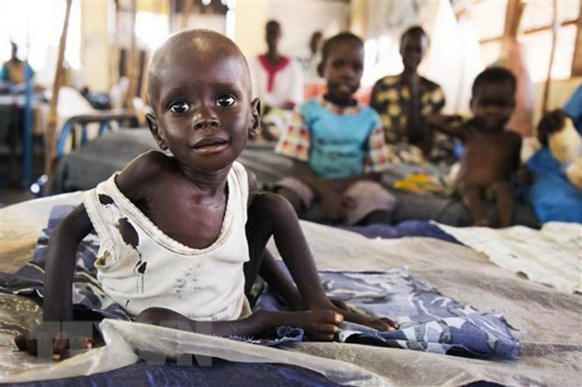 Malnourished children in South Sudan are in dire need of international support. (Photo: AFP).